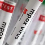 Número de casos de Mpox no Brasil chega a 140 em 2026